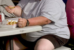 Obezitenin en önemli nedenleri açıklandı